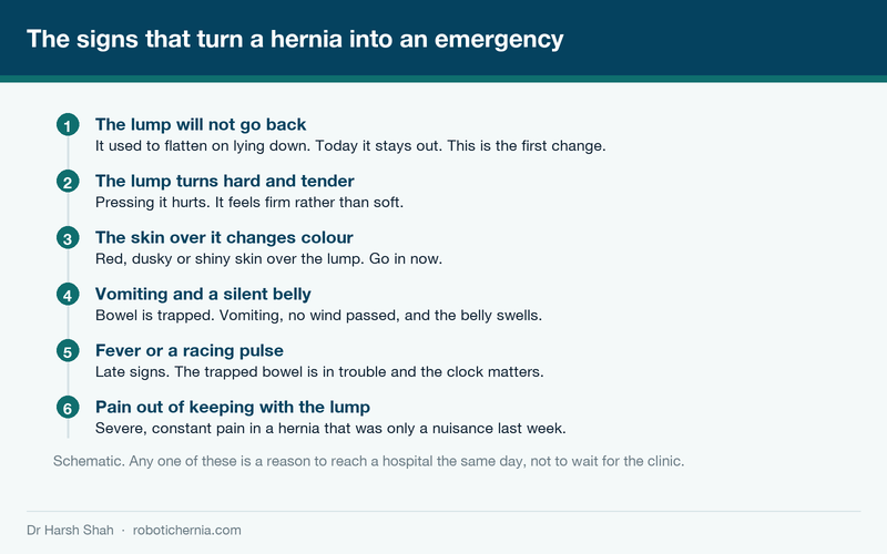 Diagram of the six warning signs that a hernia has become trapped and needs emergency surgery