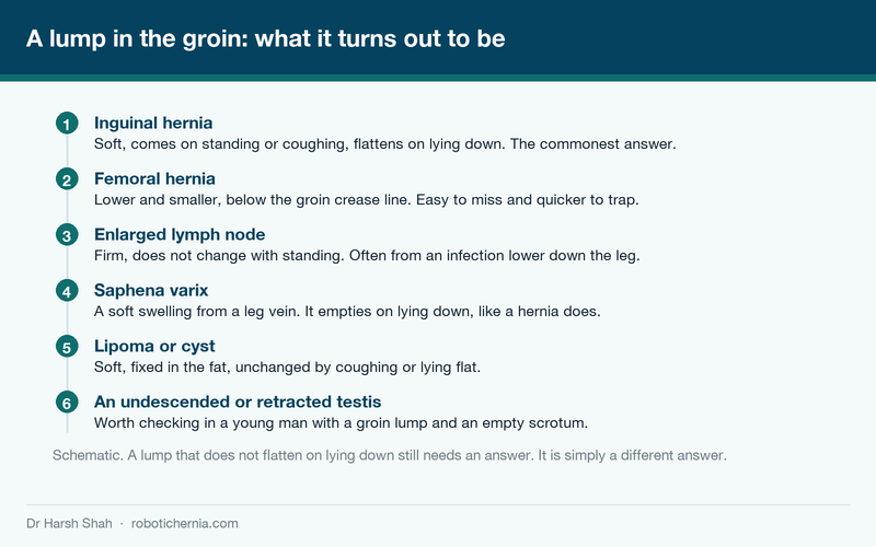 Diagram of the six common causes of a groin lump and how each one behaves on standing and lying down