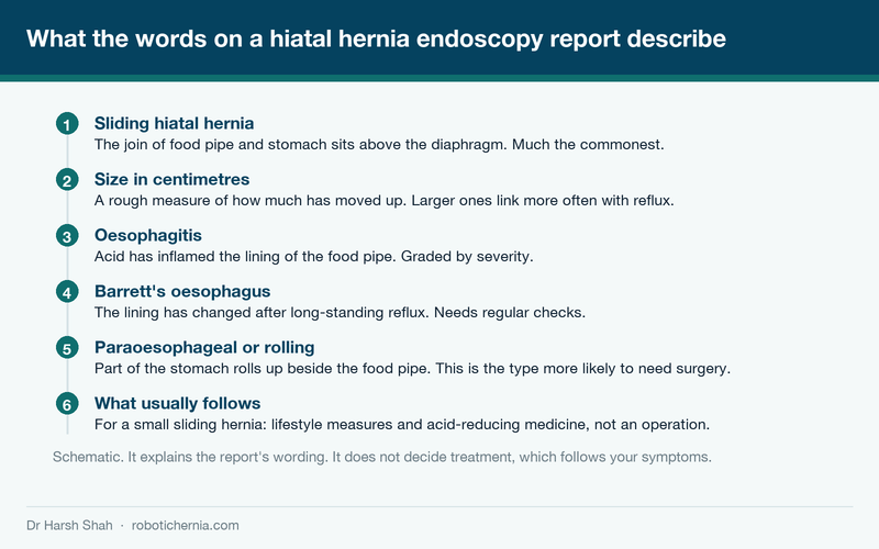 Schematic explaining the terms that appear on a hiatal hernia endoscopy report, from sliding hernia to Barrett's oesophagus