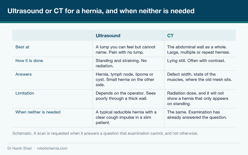 Schematic comparing which hernia question an ultrasound answers and which one needs a CT scan